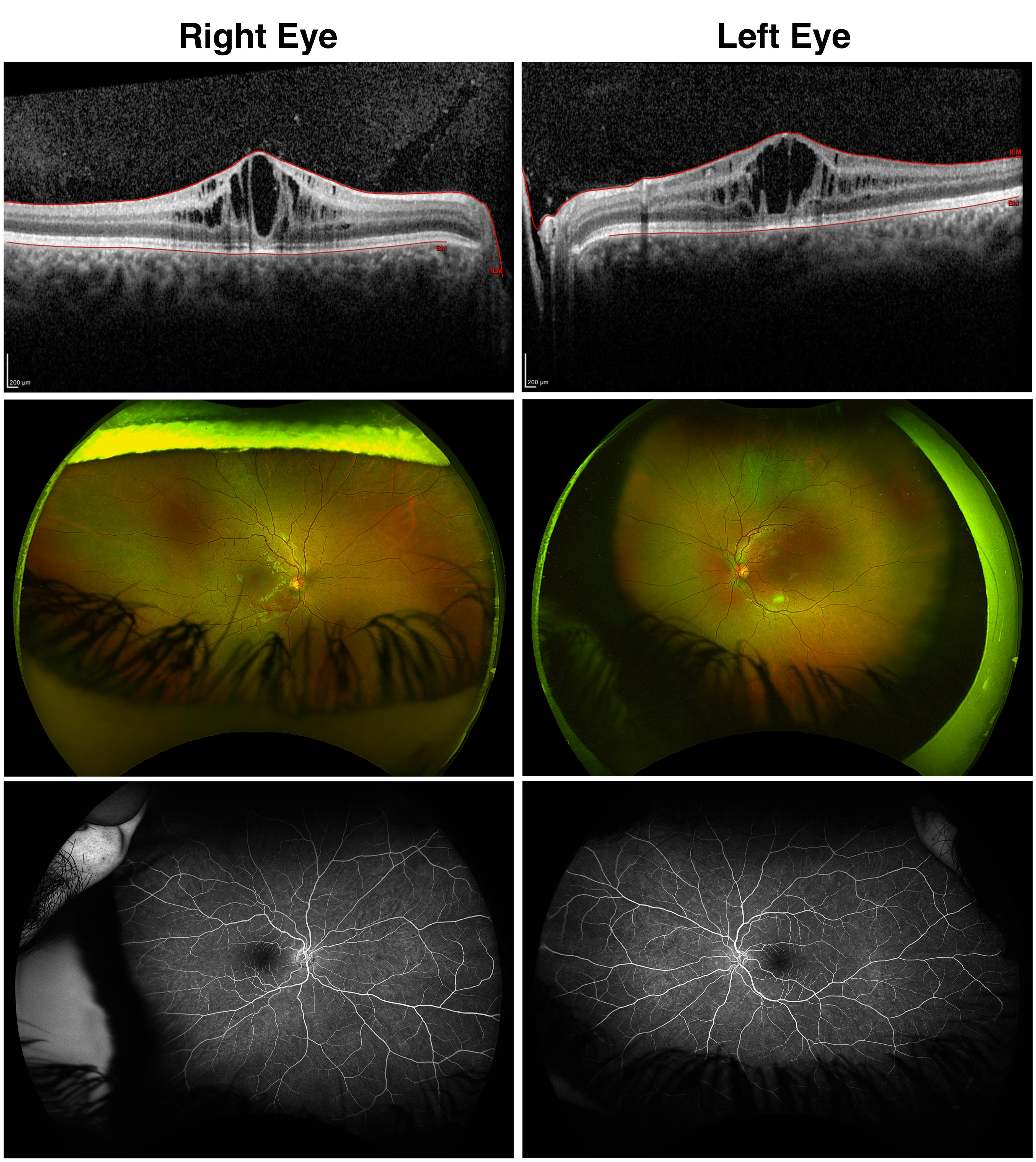 Order Testing Like a Pro Retina Today